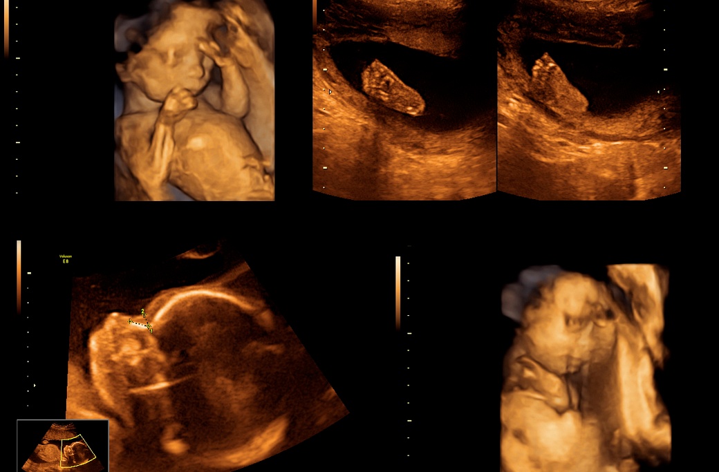 Как да изберем детски гумени ботуши? Ръководство за родители