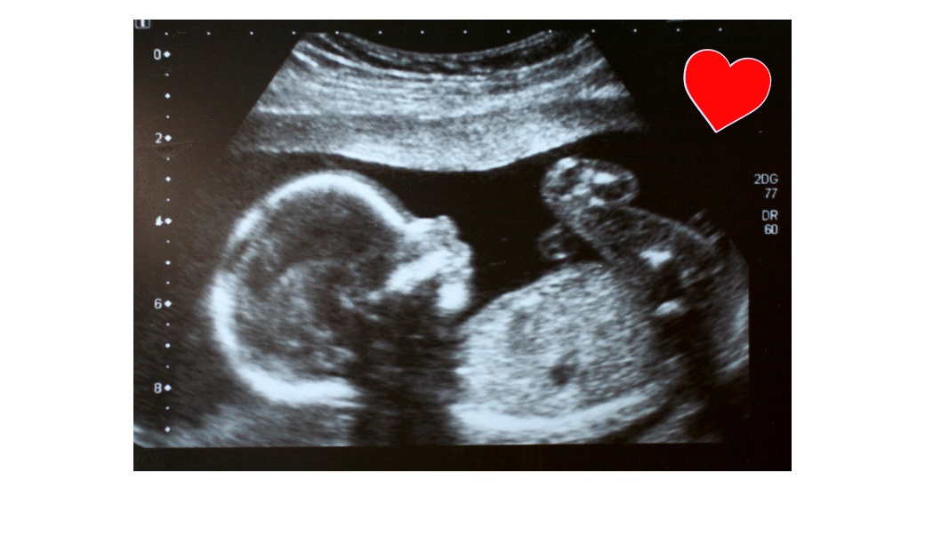 Как да изберем детски гумени ботуши? Ръководство за родители