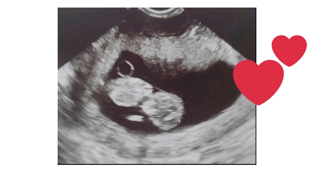 Как да изберем детски гумени ботуши? Ръководство за родители