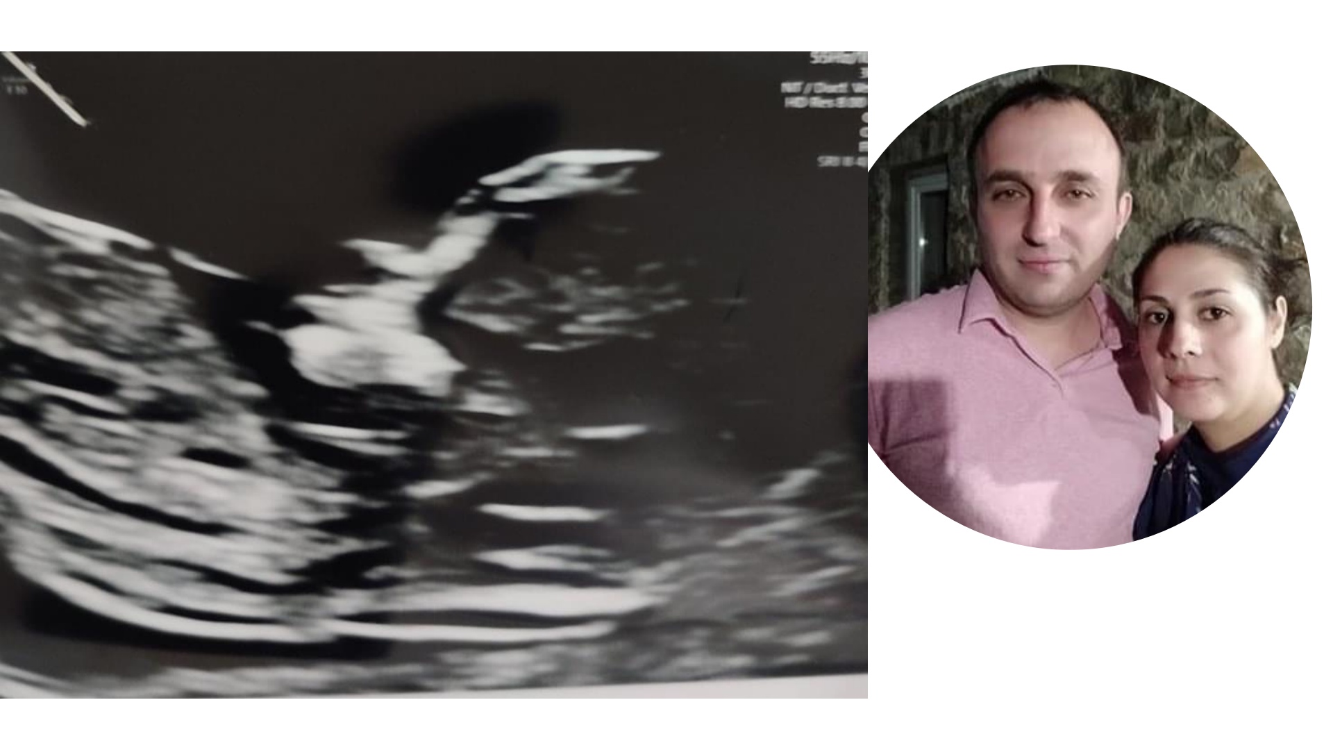 Как да изберем детски гумени ботуши? Ръководство за родители